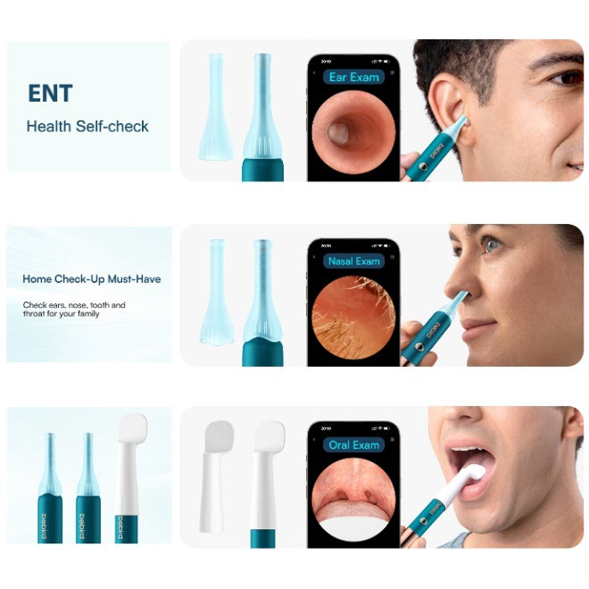 EarSight Ultra Visual Earwax Removal Kit with Wireless Otoscope & Accessories by Bebird