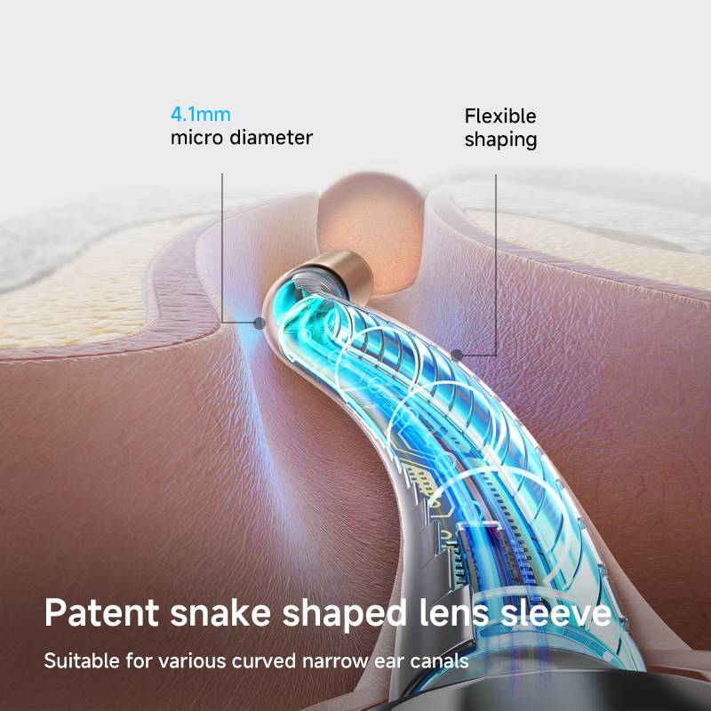 Earsight Plus Ear Wax Removal Tool with Camera by Bebird | Ear Wax Removal | SASKA Trading