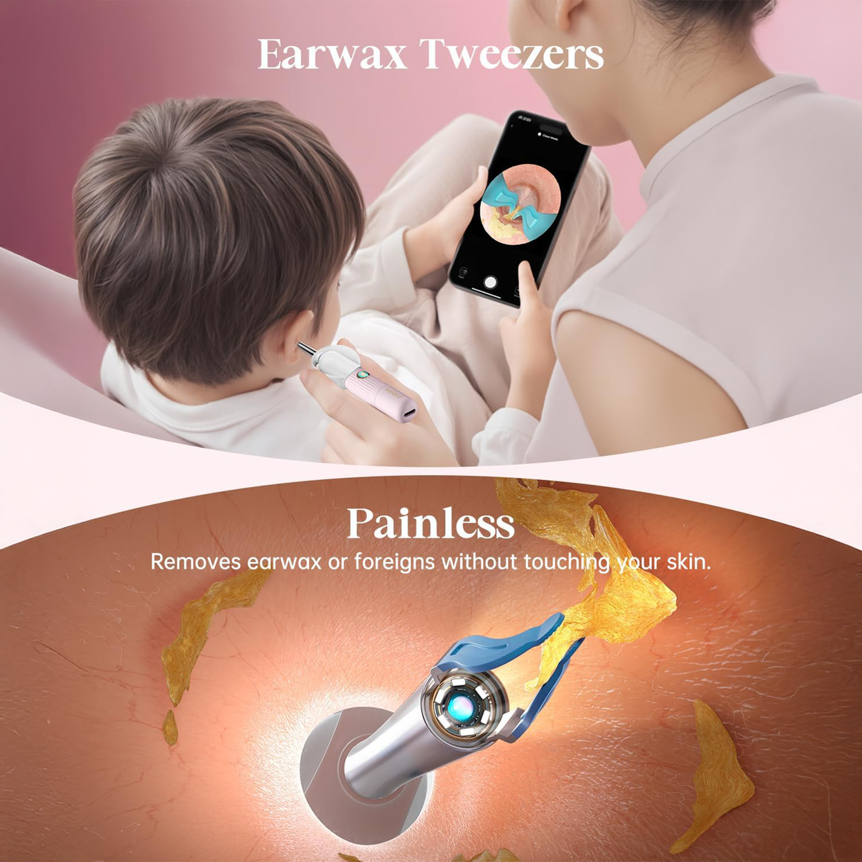 Earsight Plus Ear Wax Removal Tool with Camera by Bebird