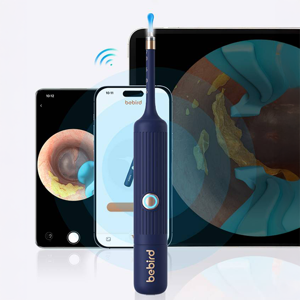 Earsight Plus Ear Wax Removal Tool with Camera by Bebird | Ear Wax Removal | SASKA Trading
