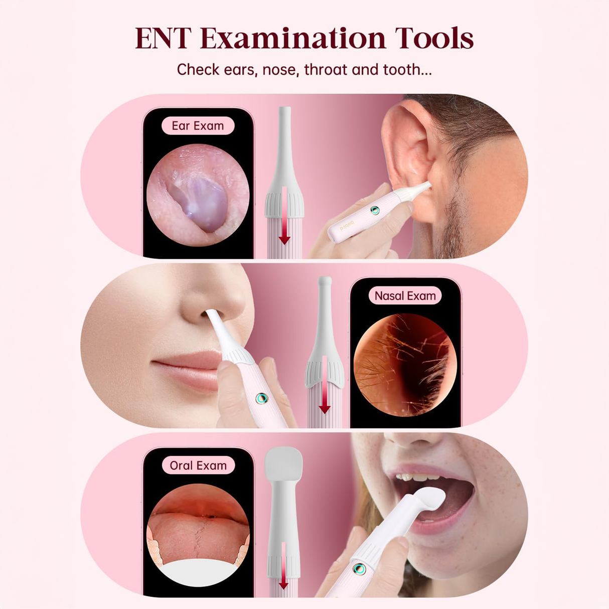 Earsight Plus Ear Wax Removal Tool with Camera by Bebird