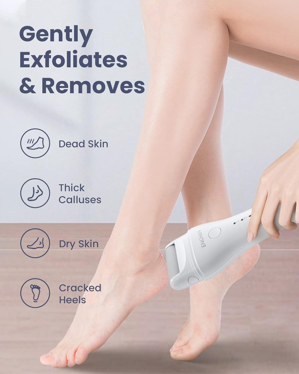 Electric Foot Callus Remover by Enchen Rock | Foot Care | SASKA Trading