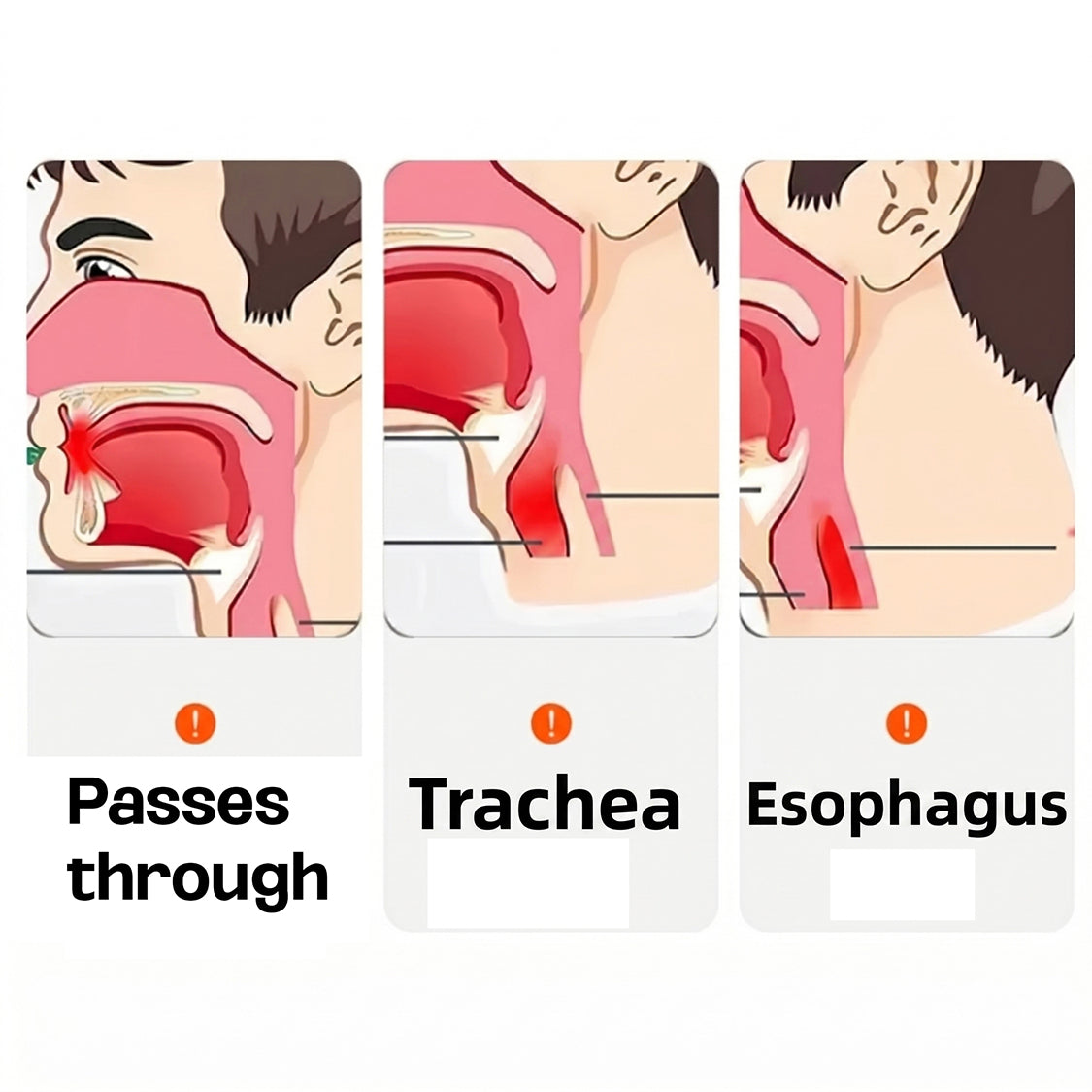 Portable Anti-Choking Rescue Device Emergency Airway Suction Tool for Children, Adults & Elderly by CRFISH