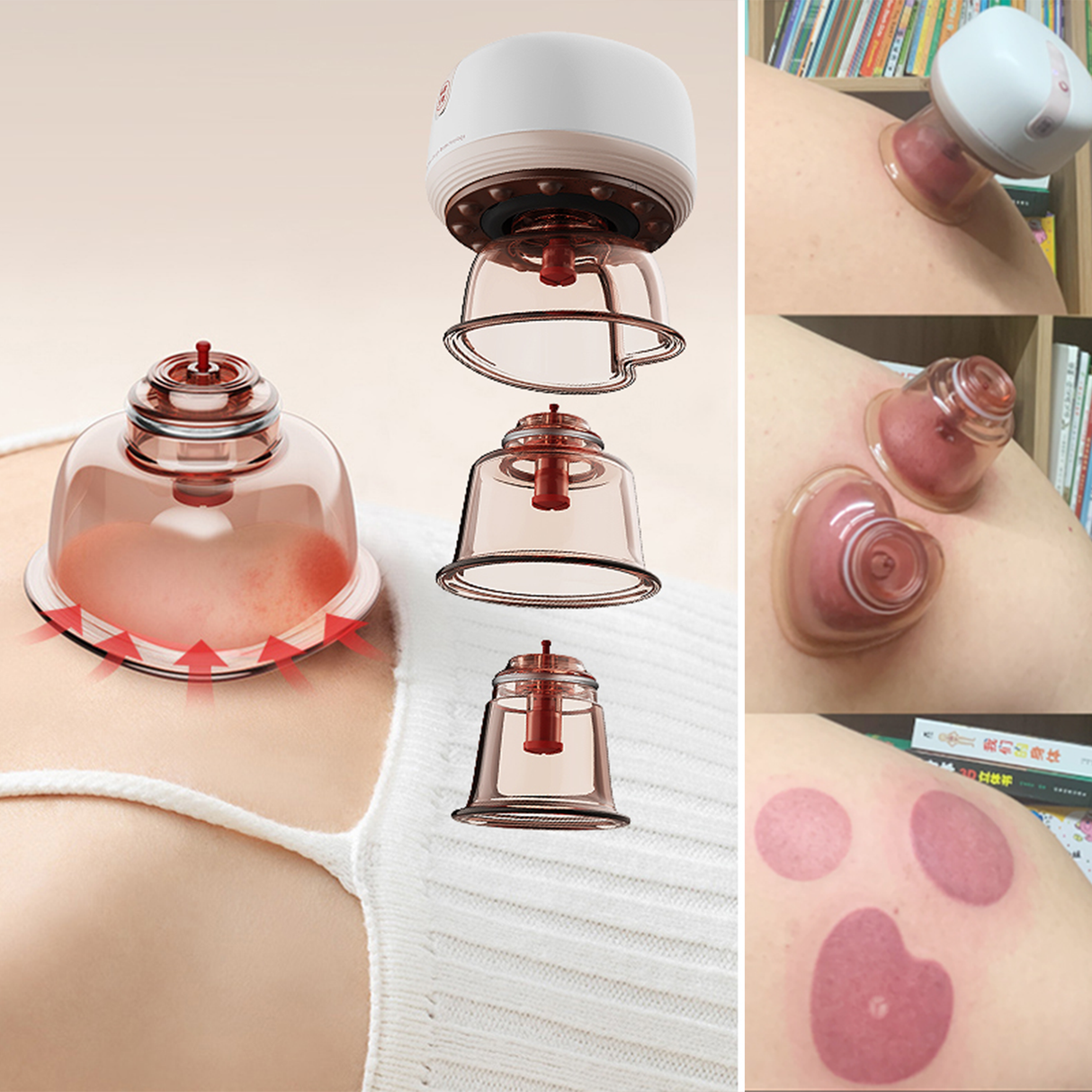 Smart Cupping Therapy Kit Automatic and Manual Set by TechLove | Massager | SASKA Trading