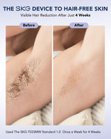 Laser Hair Removal Device by SKG - SASKA Trading